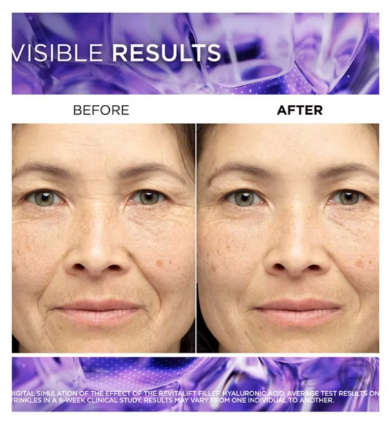 L'Oreal Paris Revitalift Filler Hyaluronic Acid Anti-Wrinkle Serum, 1.5% Pure Concentrated Micro-Epidermic Hyaluronic Acid, 30ml